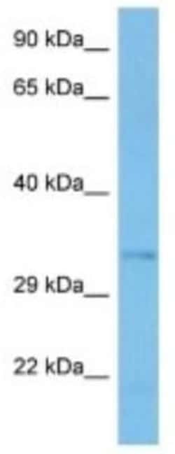 C7orf57 Rabbit anti-Mouse, Polyclonal, Novus Biologicals:Antibodies:Primary